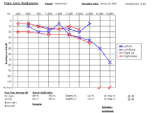 Audiogram